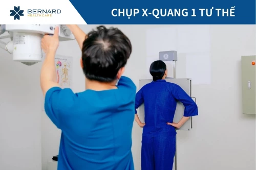 Chụp X-quang 1 tư thế